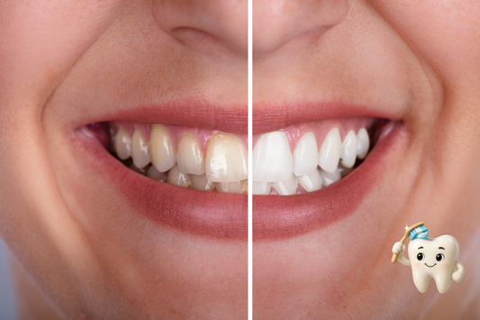 The Truth About Whitening Toothpaste