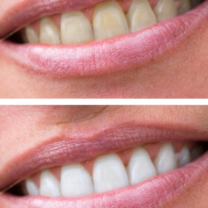 Pearly Whitening Toothpaste Bundle 2 - pack